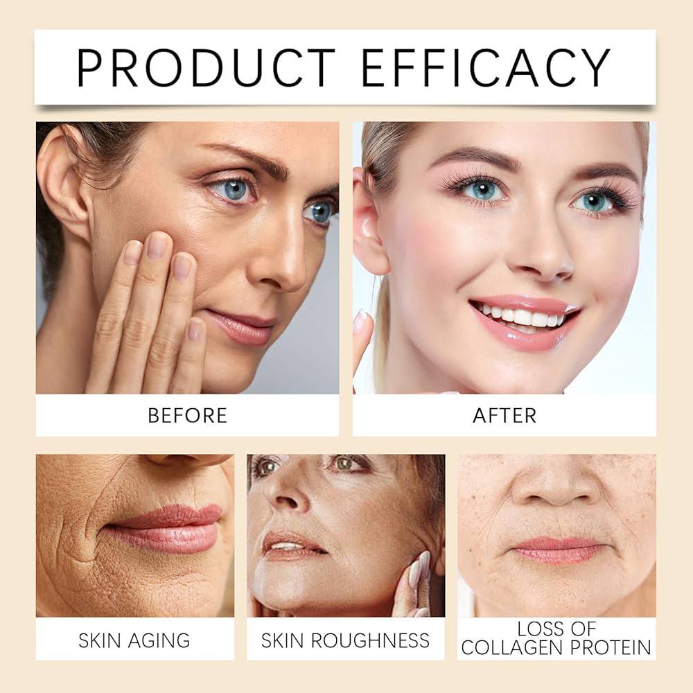 Aobenz Dark spot correcting serum