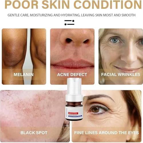 Aobenz Dark spot correcting serum