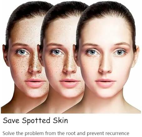 Aobenz Dark spot correcting serum